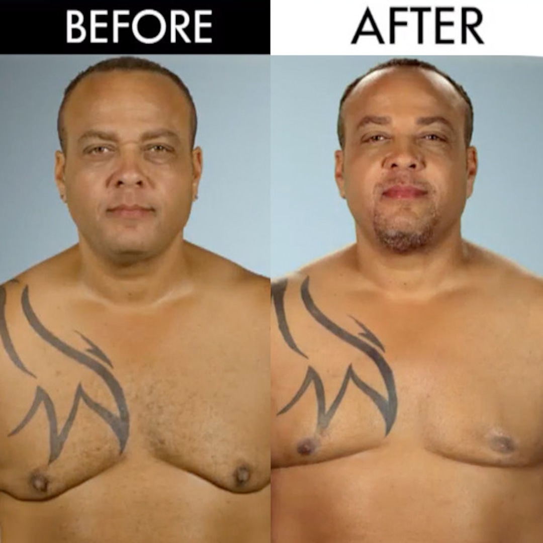 Man Boobs & Butt Implants?! See the Botched Before and Afters!